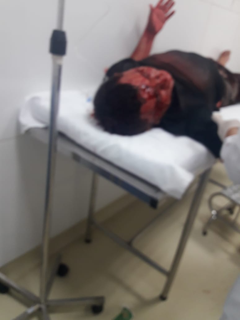 NOITE DE TERROR EM BACABAL QUE FOI INVADIDA POR BANDIDOS, ALGUNS JÁ MORTOS EM TROCA DE TIROS COM A PM.