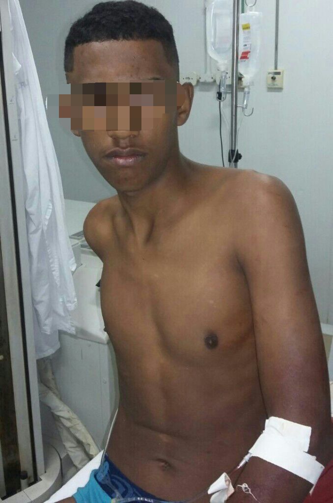 JOVEM APONTA ARMA PARA POLICIAL EM CODÓ E ACABA LEVANDO UM TIRO DO PM.
