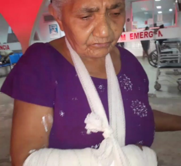 IDOSA É BALEADA DURANTE TIROTEIO QUE MATOU JOVEM COM 5 TIROS HOJE EM CODÓ