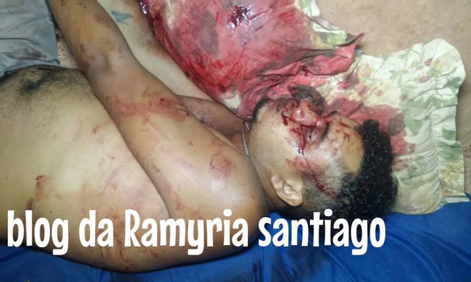 HOMEM ACABA DE SER EXECUTADO EM CODÓ COM UM TIRO NA CLAVÍCULA.