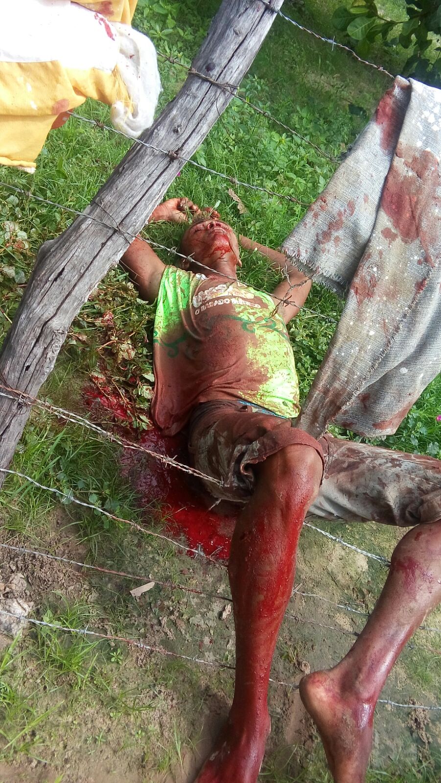 Jovem é assassinado com vários golpes de facão agora pouco no bairro Olaria em Timbiras!