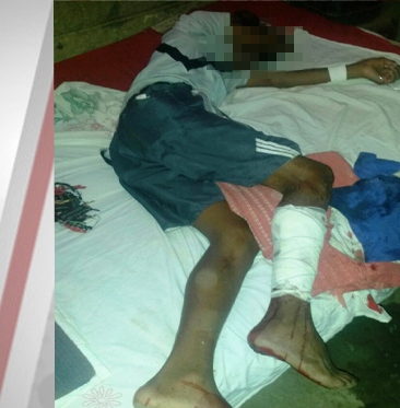 Jovem atira acidentalmente contra o amigo em Codó