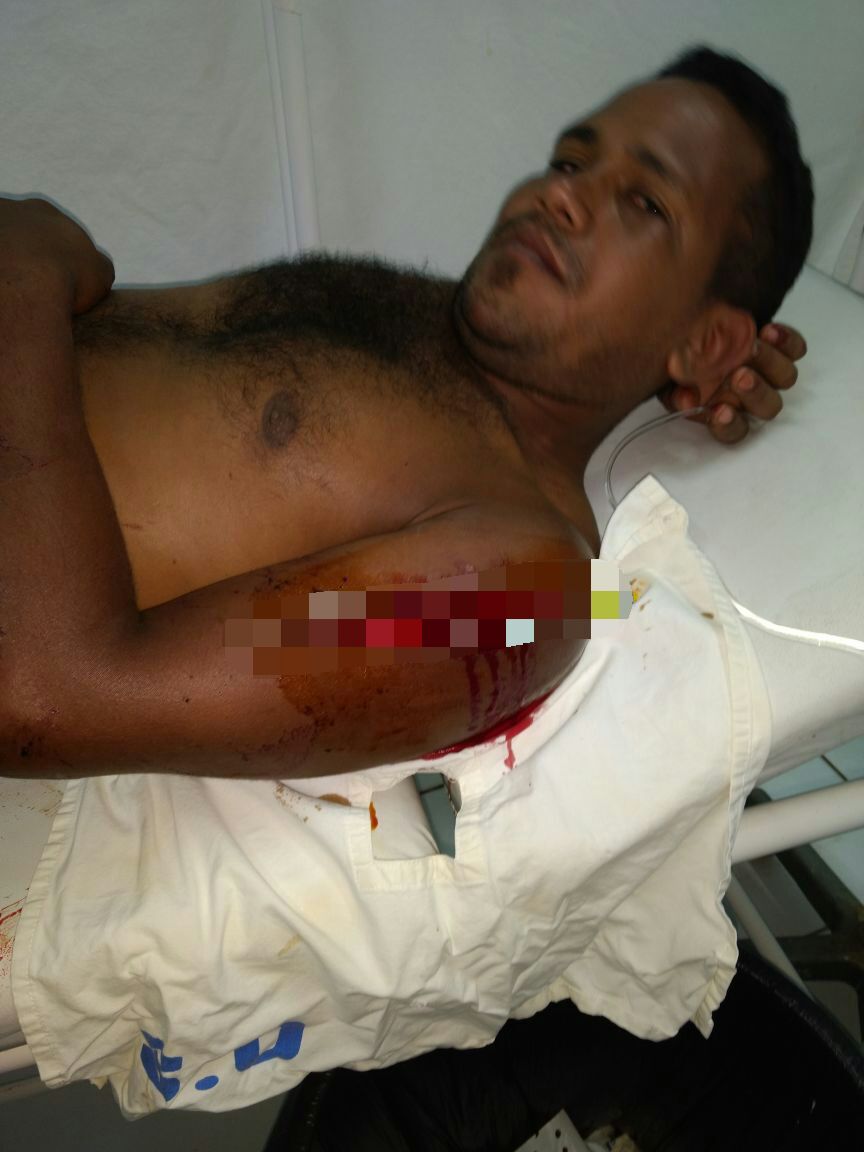 TENTATIVA DE HOMICÍDIO EM CODÓ – LUKINHA ATACA DE NOVO