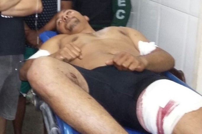 Diretor do Complexo Penitenciário de Pedrinhas é baleado na porta de casa