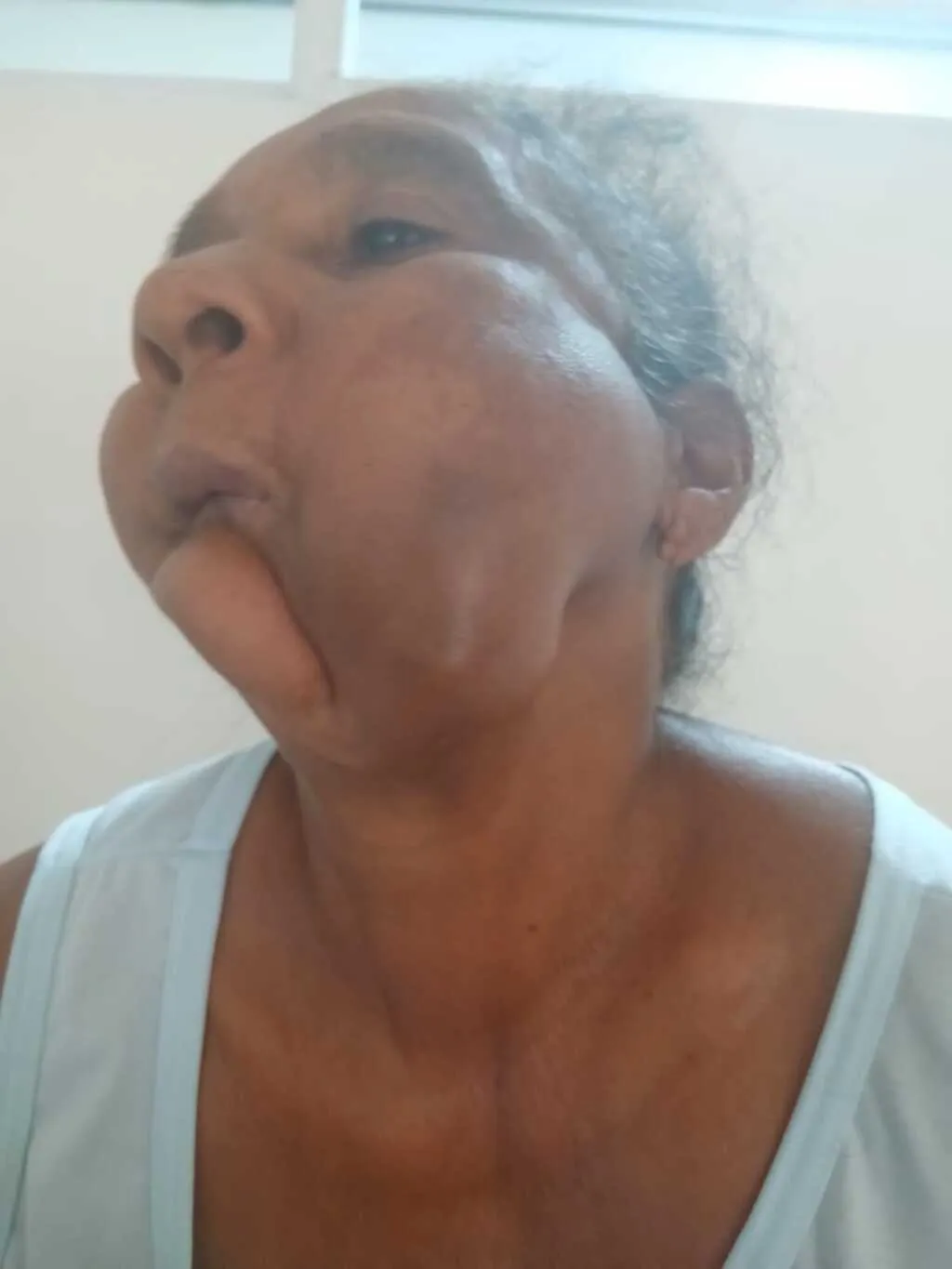 HGM é alvo de denúncia: filha acusa hospital de abandonar paciente há mais de um mês sem cirurgia e sem transferência