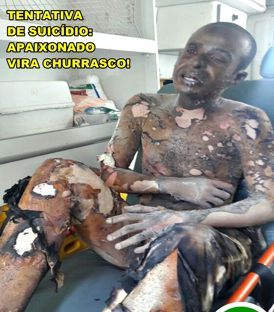 TENTATIVA DE SUICÍDIO: HOMEM COLOCA FOGO NO PRÓPRIO CORPO  POR AMOR.