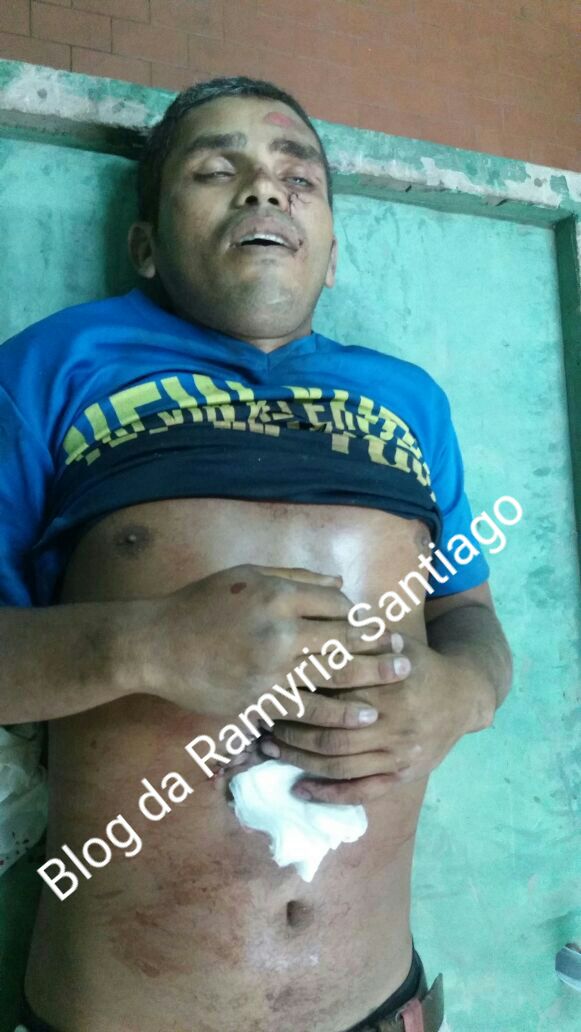 JOVEM DE 28 ANOS É ASSASSINADO NA NOITE DE ONTEM EM CODÓ 5 DE NOVEMBRO.